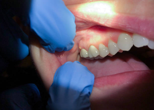 Best Emergency Dentist Near Me  in Neffs, OH