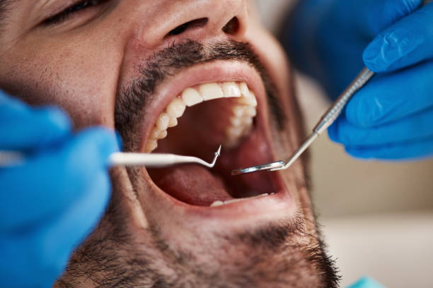Best Knocked-Out Tooth Emergency  in Neffs, OH